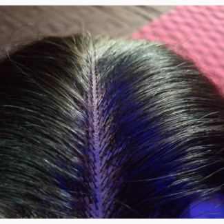 2by4 Closure