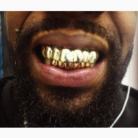 Gold Plated Teeth Grillz - Brand New, Unused, Undamaged