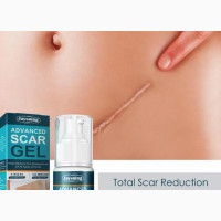 Advanced Scar Removal Gel