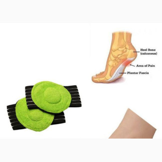 Arch Support Flat Feet Foot Fallen Plantar Fasciitis