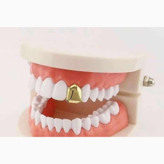 18K Italian Gold Teeth Grills Available Now