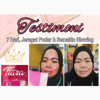 Miira Tiara(Anti Aging )
