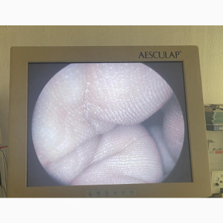 Surgical Endoscopy LCD Medical Monitor