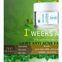 Anti Acne: Pimple, Scar, Black Spot, Oil and Burn