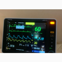 Mindray Patient Monitor
