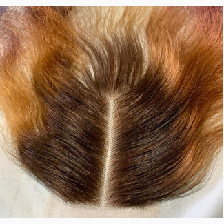 Customized Closure