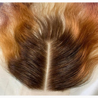 Customized Closure