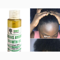 Simas Hair Growth Oil | Anti Dandruff, Fast Growth