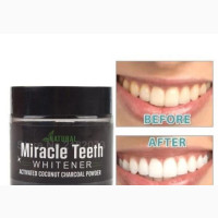 Miracle Teeth Whitening Powder - All Natural Teeth Whitener