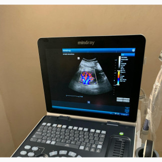 Mindray Z50 Ultrasound Machine