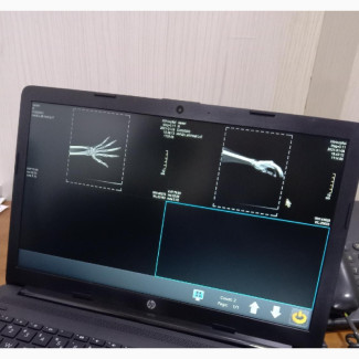 Brand New Iray Wireless Flat Panel Detector for Sale