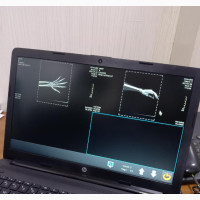 Brand New Iray Wireless Flat Panel Detector for Sale