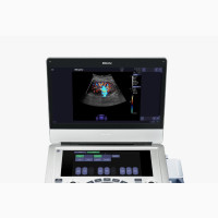 Portable 4D Ultrasound AX3