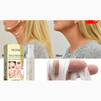Golden Protein Anti Wrinkle/Aging Removal Thread - 20pcs