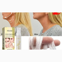 Golden Protein Anti Wrinkle/Aging Removal Thread - 20pcs