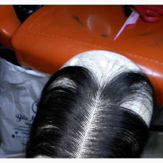 Closure and Frontal Making