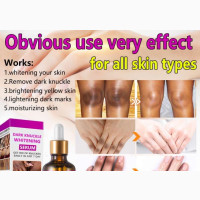 Dark Knuckle Whitening Serum
