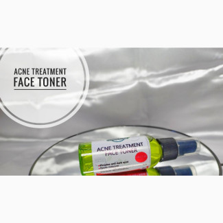 ACNE TREATMENT FACE TONER for Stubborn Dark Spots Pimples
