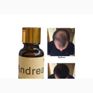 Andrei Hair Growth Oil