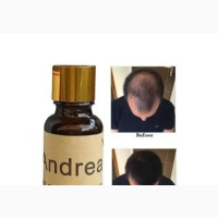 Andrei Hair Growth Oil