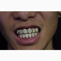 18k Gold Plated Cz Vire Grillz
