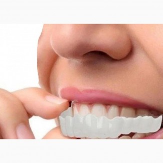 Teeth Whitening Veneers - Perfect Smile Solution
