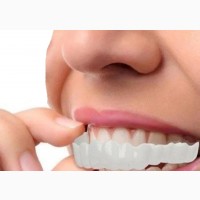 Teeth Whitening Veneers - Perfect Smile Solution