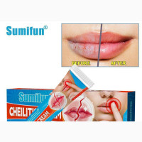 Cheilitis Anti Bacteria Anti Crack Lip Cream