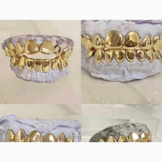 Real Gold Teeth Available in Store Dm for Yours