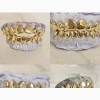 Real Gold Teeth Available in Store Dm for Yours