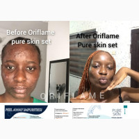 Pure Skin Set