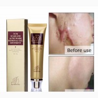 TCM Labena Skin Scar Cream