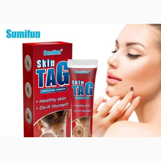 Skin Tag Removal Cream