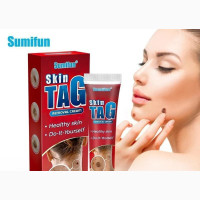 Skin Tag Removal Cream