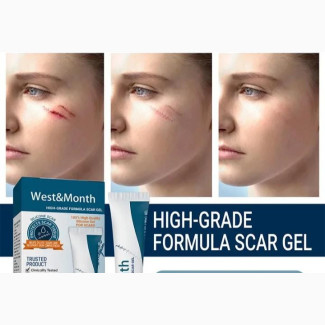 Silicon Scar Gel, Keloid Removal Gel