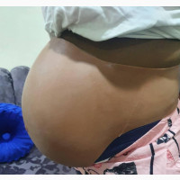 3rd Stage Silicone Fake Pregnancy Belly for Big Waist