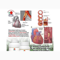 DXN Ganoderma Heart Combo - For Healthy Heart