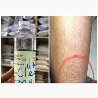 Ultra Clear Emu Moisturizing Oil 250ml