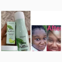 Perfect Solution for Skin Tag, Acne