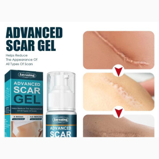Advance Scar Gel