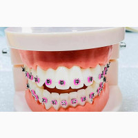 Angzhili Oral Dentistry Dental Orthodontic With Braces