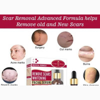 Aichun Beauty - Scar Removal Whitening Serum