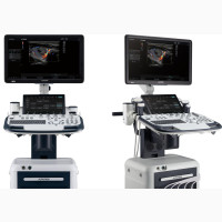 Refurbished Ultrasound Machine