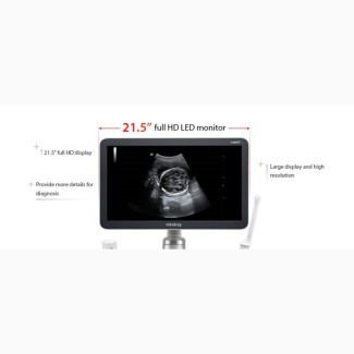 Mindray DC30 3D/4D Diagnostics Machine - Brand New