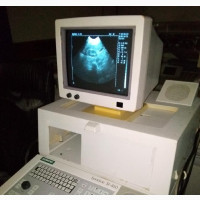 Siemens Sonoline Si 450