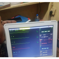 Patient Monitor