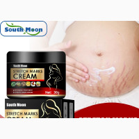 Stretch Marks Removal Cream
