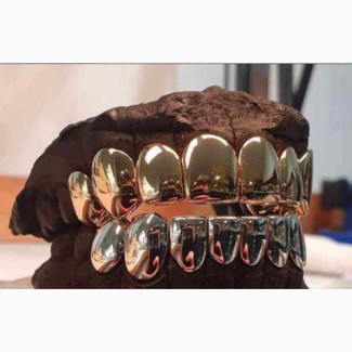 Pure Italian 18karat Gold Teeth
