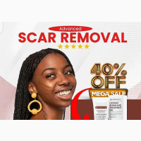 Scar Removal