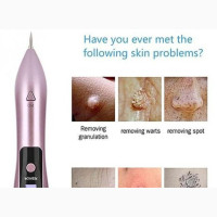 LCD Laser Plasma Pen Face Skin Dark Tag Mole Tattoo Removal